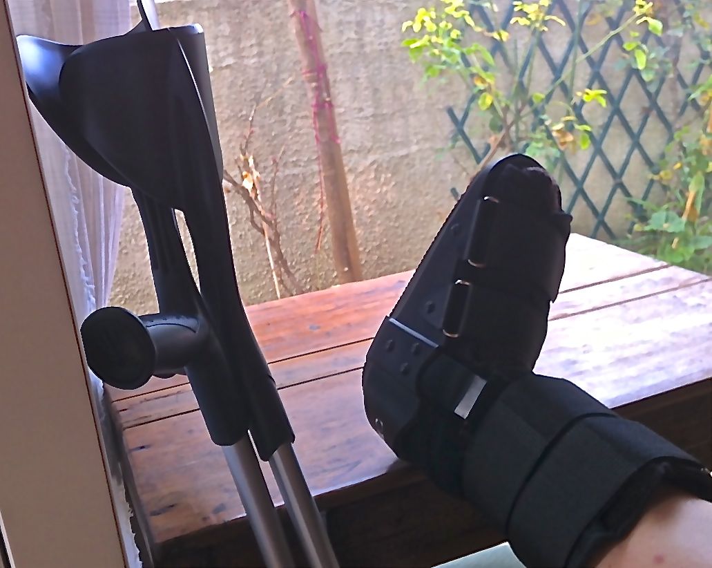 broken foot broken foot in sud de france